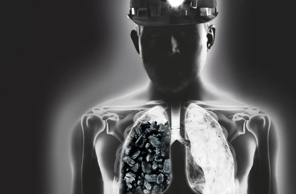 Pulmón negro arrasa con una nueva generación de mineros