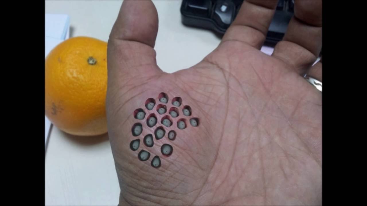 Hoyos en la piel y huecos en las manos Qué son realmente y por qué nos causan tripofobia